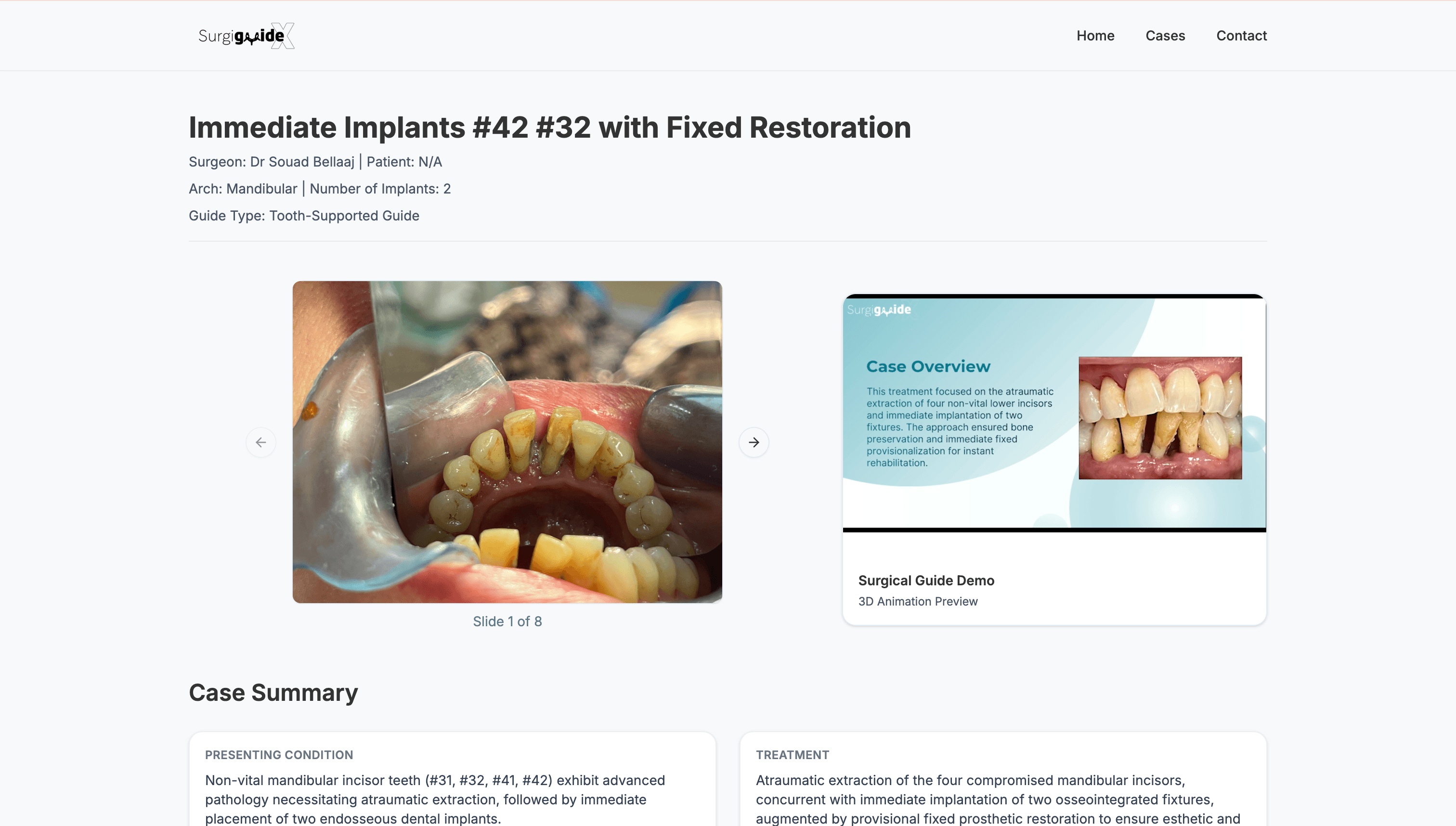 SurgiGuideX – Digital Surgical Guide Platform - Detailed Case Review & Clinical Visualization